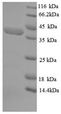 Recombinant Human Striated muscle preferentially expressed protein kinase (SPEG), partial – Figure 1 of 1