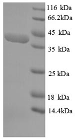 Recombinant Human Striated muscle preferentially expressed protein kinase (SPEG), partial – Figure 1 of 1