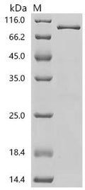 Recombinant Human Transcription factor PU.1 (SPI1), Biotinylated – Figure 1 of 1