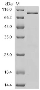 Recombinant Human Transcription factor PU.1 (SPI1), Biotinylated – Figure 1 of 1