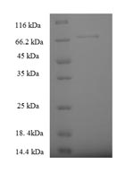 Recombinant Human Serine palmitoyltransferase 2 (SPTLC2), partial – Figure 1 of 1