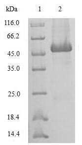 (Tris-Glycine gel) Discontinuous SDS-PAGE (reduced) with 5% enrichment gel and 15% separation gel.