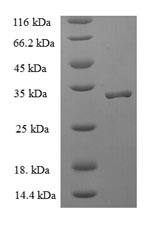 Recombinant Human Signal recognition particle 19KDA protein (SRP19) – Figure 1 of 1
