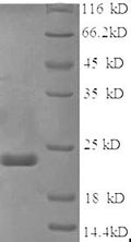 Recombinant Mouse Sex-determining region Y protein (Sry), partial – Figure 1 of 1