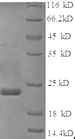 Recombinant Mouse Sex-determining region Y protein (Sry), partial – Figure 1 of 1