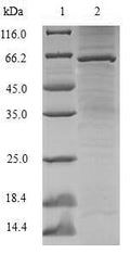Recombinant Human Lupus La protein (SSB) – Figure 1 of 1