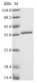 (Tris-Glycine gel) Discontinuous SDS-PAGE (reduced) with 5% enrichment gel and 15% separation gel.