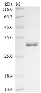 (Tris-Glycine gel) Discontinuous SDS-PAGE (reduced) with 5% enrichment gel and 15% separation gel.