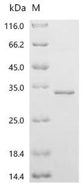 (Tris-Glycine gel) Discontinuous SDS-PAGE (reduced) with 5% enrichment gel and 15% separation gel.