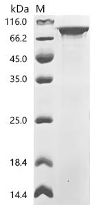 Recombinant Human Signal transducer and activator of transcription 1-alpha/beta (STAT1) – Figure 1 of 1