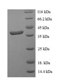 Recombinant Human Signal transducer and activator of transcription 3 (STAT3), partial – Figure 1 of 1