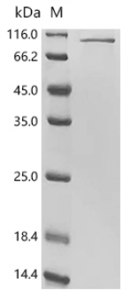 (Tris-Glycine gel) Discontinuous SDS-PAGE (reduced) with 5% enrichment gel and 15% separation gel.
