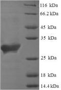 Recombinant Human Saitohin (STH) – Figure 1 of 1