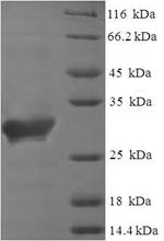 Recombinant Human Saitohin (STH) – Figure 1 of 1
