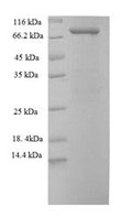 Recombinant Human Stress-induced-phosphoprotein 1 (STIP1) – Figure 1 of 1