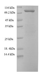 Recombinant Human Stress-induced-phosphoprotein 1 (STIP1) – Figure 1 of 1