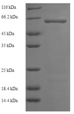 Recombinant Human Serine/threonine-protein kinase 25 (STK25) – Figure 1 of 1