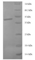 Recombinant Human Syntaxin-10 (STX10), partial – Figure 1 of 1