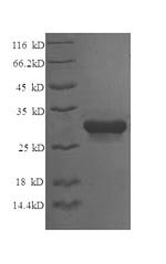 Recombinant Chicken Syntaxin-6 (STX6), partial – Figure 1 of 1