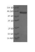 Recombinant Human Syntaxin-6 (STX6), partial – Figure 1 of 1