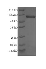 Recombinant Human Syntaxin-6 (STX6), partial – Figure 1 of 1