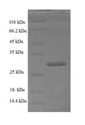 Recombinant Human Activated RNA polymerase II transcriptional coactivator p15 (SUB1) – Figure 1 of 1