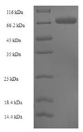 Recombinant Human Sulfite oxidase, mitochondrial (SUOX) – Figure 1 of 1