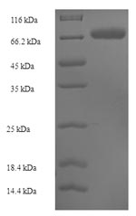 Recombinant Human Sulfite oxidase, mitochondrial (SUOX) – Figure 1 of 1