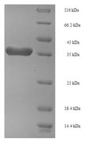 Recombinant Arabidopsis thaliana FACT complex subunit SPT16 (SPT16), partial – Figure 1 of 1
