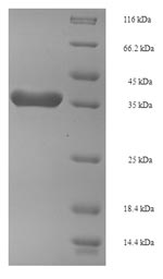 Recombinant Arabidopsis thaliana FACT complex subunit SPT16 (SPT16), partial – Figure 1 of 1
