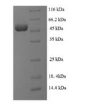 Recombinant Human Transcription initiation protein SPT3 homolog (SUPT3H), partial – Figure 1 of 1
