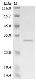 (Tris-Glycine gel) Discontinuous SDS-PAGE (reduced) with 5% enrichment gel and 15% separation gel.