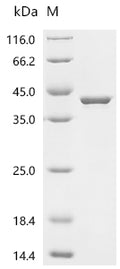 (Tris-Glycine gel) Discontinuous SDS-PAGE (reduced) with 5% enrichment gel and 15% separation gel.