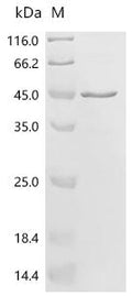 (Tris-Glycine gel) Discontinuous SDS-PAGE (reduced) with 5% enrichment gel and 15% separation gel.