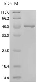 Recombinant Human Transaldolase (TALDO1) – Figure 1 of 1