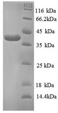 Recombinant Human TRAF family member-associated NF-kappa-B activator (TANK), partial – Figure 1 of 1