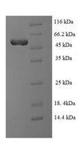 (Tris-Glycine gel) Discontinuous SDS-PAGE (reduced) with 5% enrichment gel and 15% separation gel.