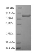 Recombinant Human Threonine--tRNA ligase, mitochondrial (TARS2), partial – Figure 1 of 1