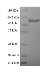 Recombinant Human Threonine--tRNA ligase, mitochondrial (TARS2), partial – Figure 1 of 1