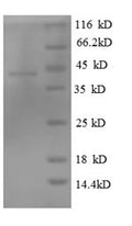 Recombinant Human Tubulin-specific chaperone C (TBCC) – Figure 1 of 1