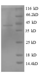 Recombinant Human Tubulin-specific chaperone C (TBCC) – Figure 1 of 1