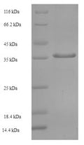 Recombinant Human TATA box-binding protein-like protein 1 (TBPL1), partial – Figure 1 of 1