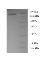 Recombinant Human T-box transcription factor TBX18 (TBX18) – Figure 1 of 1