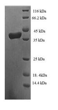 Recombinant Human Elongin-C (ELOC) – Figure 1 of 1