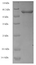 Recombinant Human Transcobalamin-1 (TCN1) – Figure 1 of 1