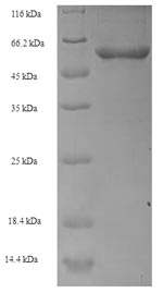 Recombinant Human Transcobalamin-1 (TCN1) – Figure 1 of 1