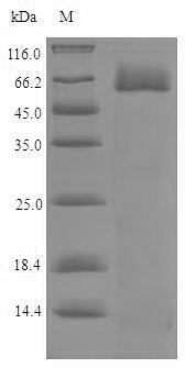 Recombinant Human Tryptophan 2,3-dioxygenase (TDO2) – Figure 1 of 1
