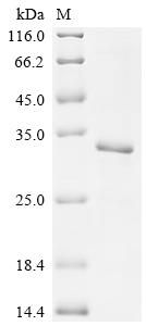 Recombinant Human Transcriptional enhancer factor TEF-1 (TEAD1), partial – Figure 1 of 1