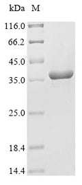 (Tris-Glycine gel) Discontinuous SDS-PAGE (reduced) with 5% enrichment gel and 15% separation gel.