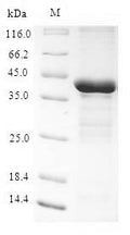 Recombinant Human Tescalcin (TESC) – Figure 1 of 1